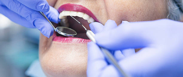 Best Emergency Root Canal Treatment in Allyn, WA